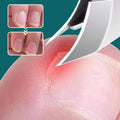ForKumi anti-splash nail kit trimming toenail close-up with before and after images