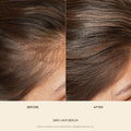 Before and after results showing hair growth using hair serum for shiny hair by ForKumi