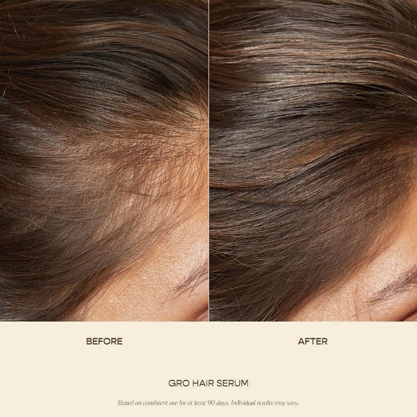 Before and after results showing hair growth using hair serum for shiny hair by ForKumi