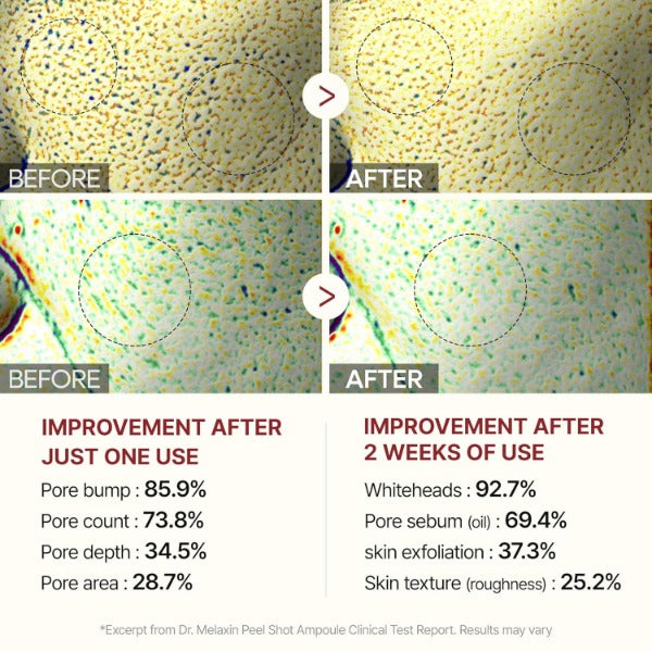 Before and after images showing skin pore improvement using rice enzyme exfoliator after one use and two weeks