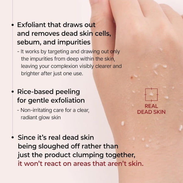 Close-up of hand with dead skin flakes showing the rice enzyme exfoliator effect by ForKumi