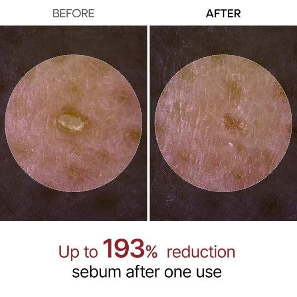 ForKumi rice enzyme exfoliator ampoule bottles with white dropper caps and clear packaging